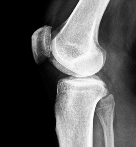 download xray download xray